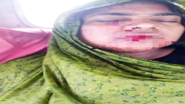 আমতলীতে তুচ্ছ ঘটনাকে কেন্দ্র করে হামলার অভিযোগ, নারী আহত, স্