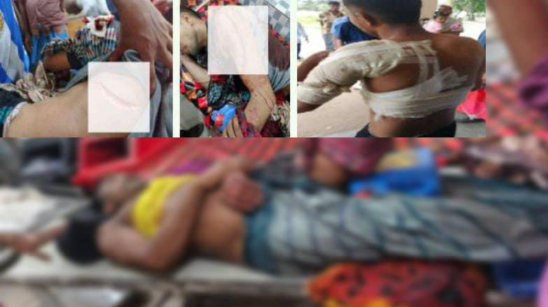 বরগুনার পাথরঘাটায় পৃথক হামলায় আহত ২!