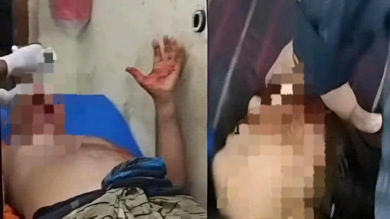 বরগুনায় টাকা দিতে না পারায় কোদালের আঘাতে রক্তাক্ত বাবা ও ভাইয়ের স্ত্রী: আহত ২