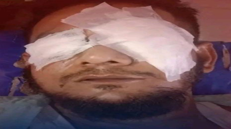 আমতলীতে সড়ক অবরোধ ঘিরে ব্যবসায়ীকে পিটিয়ে জখম...